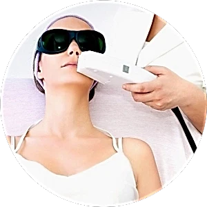 Лазерная эпиляция верхней губы