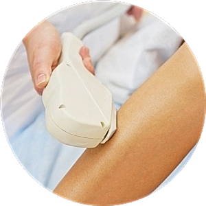 Лазерная эпиляция рук Лазерная эпиляция рук