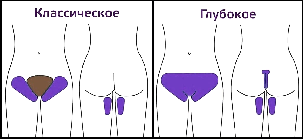 бикини.jpg бикини.jpg